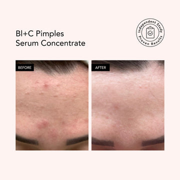 Bl+C Pimples • Black Cumin + Cajeput • Serum Concentrate