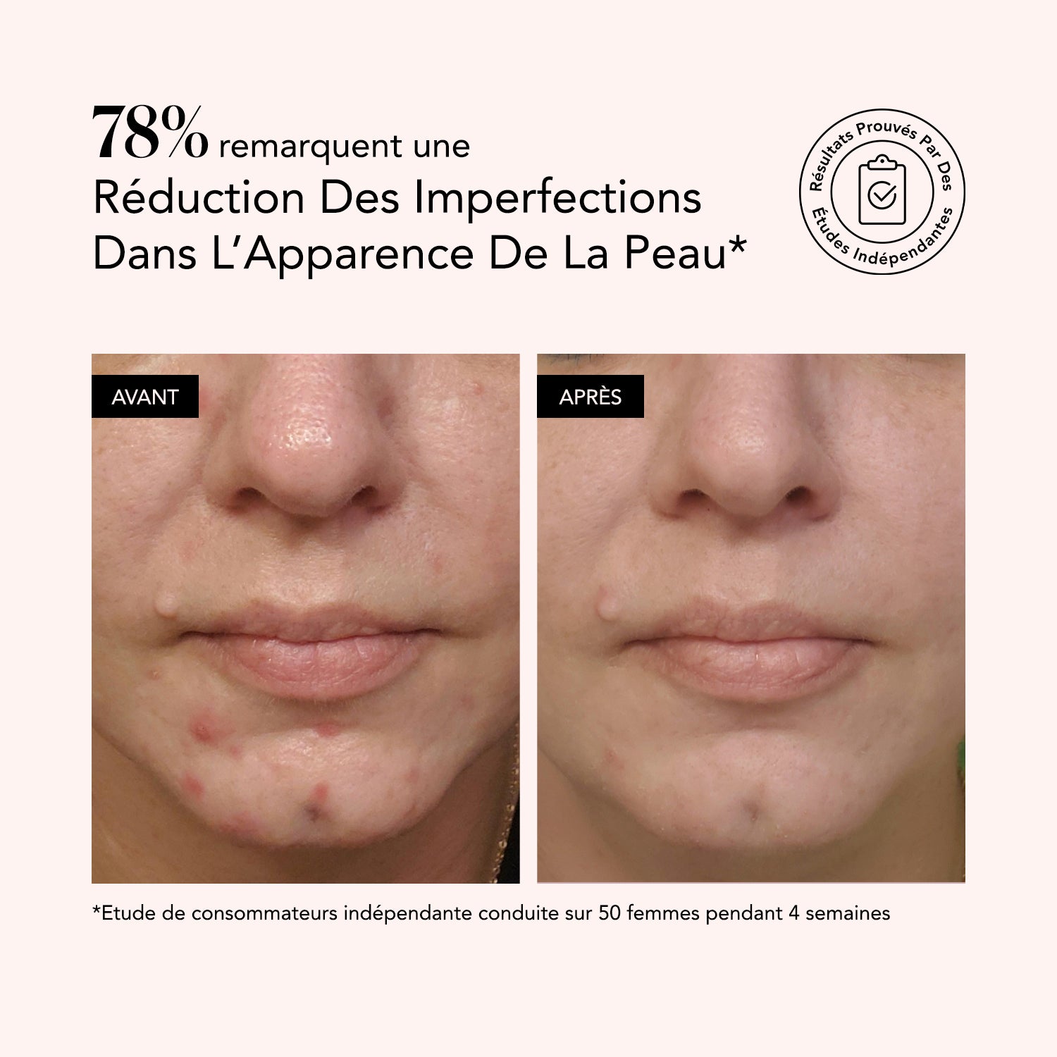 Sérum Clarifiant Acide Salicylique + Acide Hyaluronique